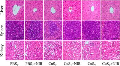 Photothermal effects of CuS-BSA nanoparticles on H22 hepatoma-bearing mice